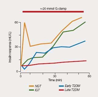 Inzulin jellegzetes értékváltozásai OGT vizsgálat során,