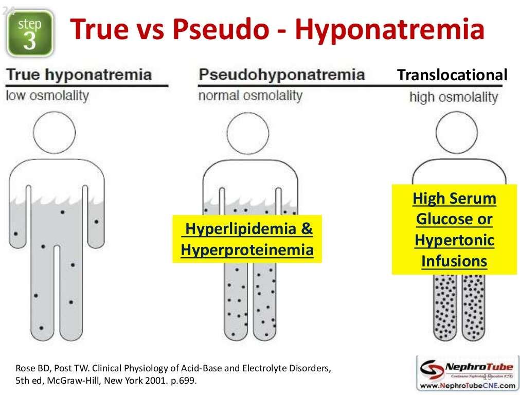 Hyperglycaemia