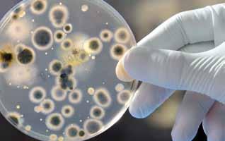 A kitettség végén a kémcsöveken először makroszkopikus értékelést végeznek, ezt követően a gombák és baktériumok fejlődését és túlélését mikroszkópikusan és biokémiailag elemzik.