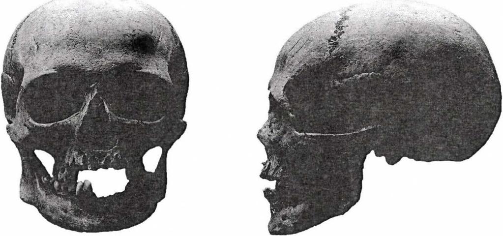 ; sírszám: Q25). Figure 15: A 15-18 year-old juvenile, anterior and lateral view. Atlanto-mediterranean-x (inv. no.: 2013.9.10.; grave no.: Q25). 16. ábra.