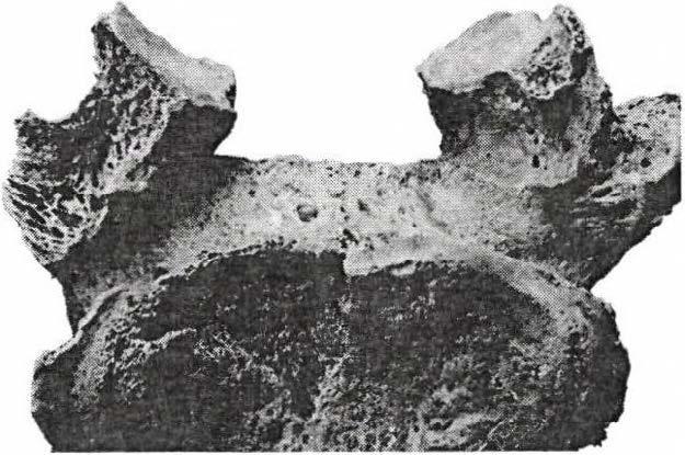 Figure 3: Spondylarthrosis (a 50-60 years old male; inv. no.: 2008.17.5.; grave no.