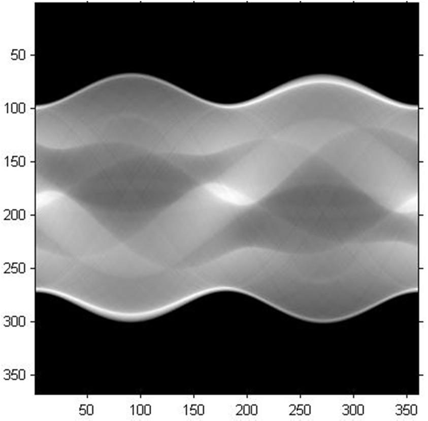 2D Radon transzformáció: Radon transzformáció (2D szelet 1D projekciók): Input: 2D Descartes