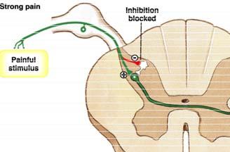 fájdalom Gátlás blokkolása Fájdalom és tapintás szekunder