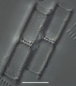 C, D: A faj vázának fénymikroszkópos képe oldalnézetben, 2-2- sejt összekapcsolódva, 1500 X-os nagyítás. Skála: 10 µm.