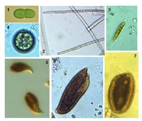 4. ábra. 1. Cyanothece aeruginosa, 2. Planktothryx aghardii, 3. Mallomonas acrocomos Ruttner, 4.