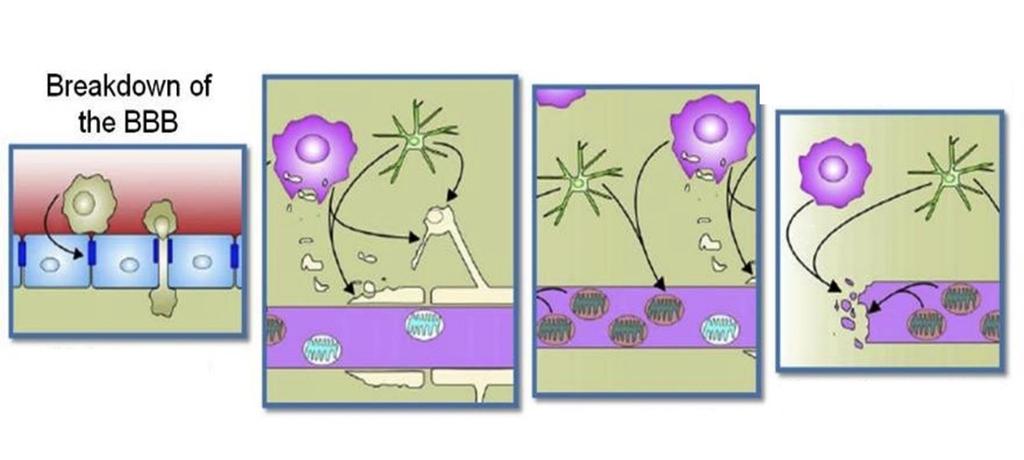 A sclerosis multiplex további progressziójának mechanizmusai Demyelinizáció Mitokondriális