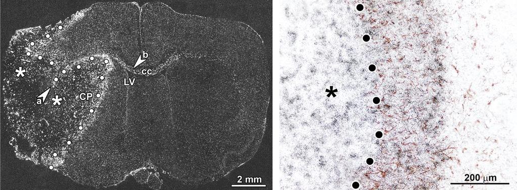 Mikroglia sejtek jelennek meg a lézió területén 3 nappal a lézió után TGF-β1 in situ hibridizációs hisztokémia + GFAP