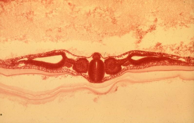 Intermedier Paraaxialis mesoderma / mesoderma nephrogonotom vel cs ectoderma