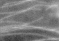 illetve β tubulin α β A mikrotubulus