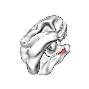 https://en.wikipedia.org/wiki/entorhinal_cortex https://en.