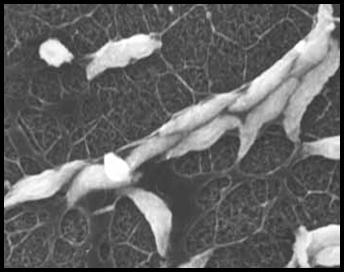 Gombák : Hálós nyálka gombák - Labyrinthulomycetes Hosszú