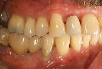 1997 Aug; 32(6): 487 496. 15. Genco RJ: Current view of risk factors for periodontal disease. J Periodontol. 67, 1041 1049, 1996. 16. Gera, I (szerk): Parodontológia. Semmelweis Kiadó, 2009. 17.