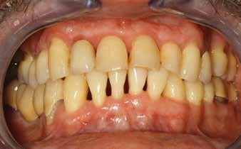 Journal of Prosthetic Dentistry. 198