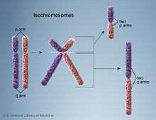 An isochromosome is an unbalanced structural abnormality in which the arms