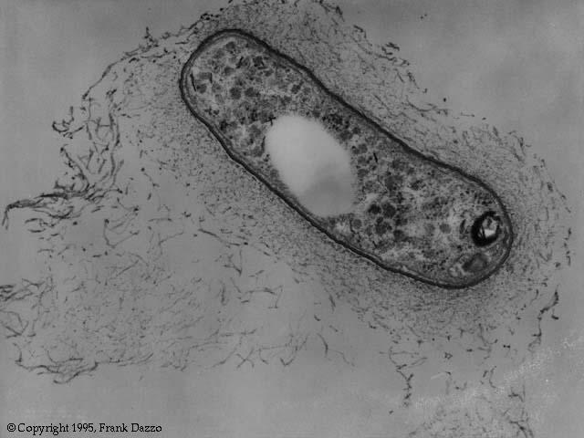 Azotobacter N 2 fixálás szabadon