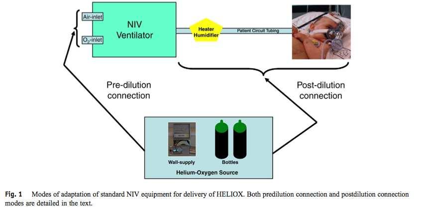 NIV lélegeztetés hélium-oxigénnel gyermekeknél (Martinon-Torres, 2012) A HELIOX komplementer th.