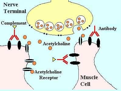 MG pathogenesis: AChR antibodies AChR abs