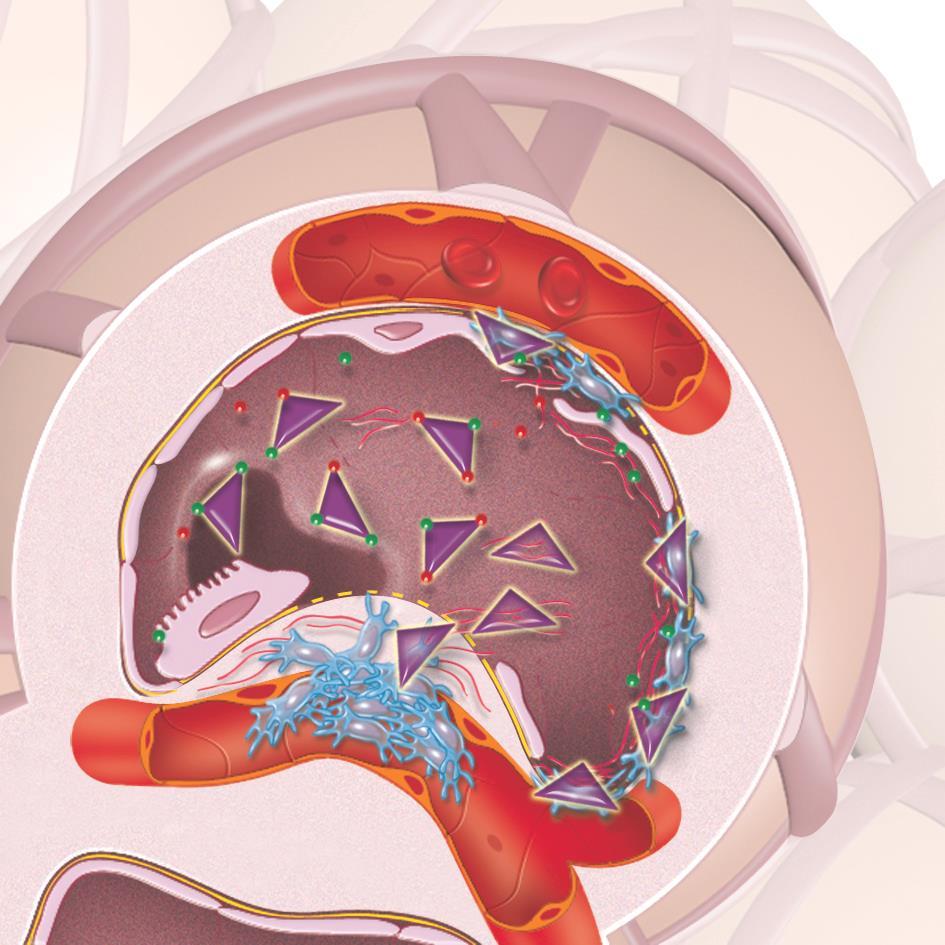 Liu H, Drew P, Gaugler AC, et al. Am J Transplant 2005;5:1256-1263. Nakayama S, Mukae H, Sakamoto N, et al. Life Sci 2008;82:210-217.