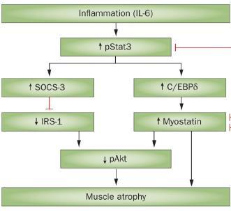 MIA szindróma malnutríció-inflammatio-ateroszklerózis -Testsúlyuk,BMI nem mindig alacsony -Se albumin csökken -Koleszterin alacsony -CRP enyhén, tartósan emelkedik -ALB SZINT A