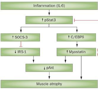 MIA szindróma malnutríció-inflammatio-ateroszklerózis -Testsúlyuk,BMI nem mindig alacsony -Se albumin csökken -Koleszterin alacsony -CRP enyhén, tartósan emelkedik -ALB SZINT A