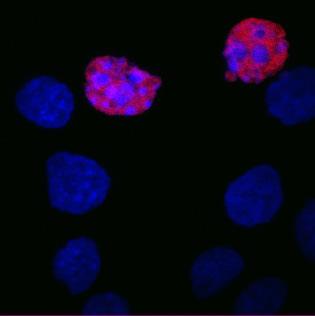 3. ábra PARP hasítás apoptózisban. A bal oldali panelen etopoziddal kezelt sejtek lizátumának Western blot analízise mutatja a 116 kda PARP-1 hasítását p89-re és a bloton nem látható p24-re.