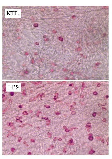 12. ábra CD11 + sejtes infiltráció endotoxinnal (LPS) kezelt patkányok íriszeiben 13. ábra Poli(ADP-ribóz) kimutatása az íriszben. (Egy kontroll kép és két uveitisb l származó íriszterület képe.