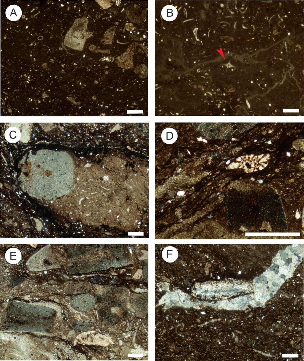 6.9. ábra. A pliensbachi és toarci rétegek mikrofácies típusai (lépték: 500 μm). A: bioklasztos és crinoideás wackestone határa.