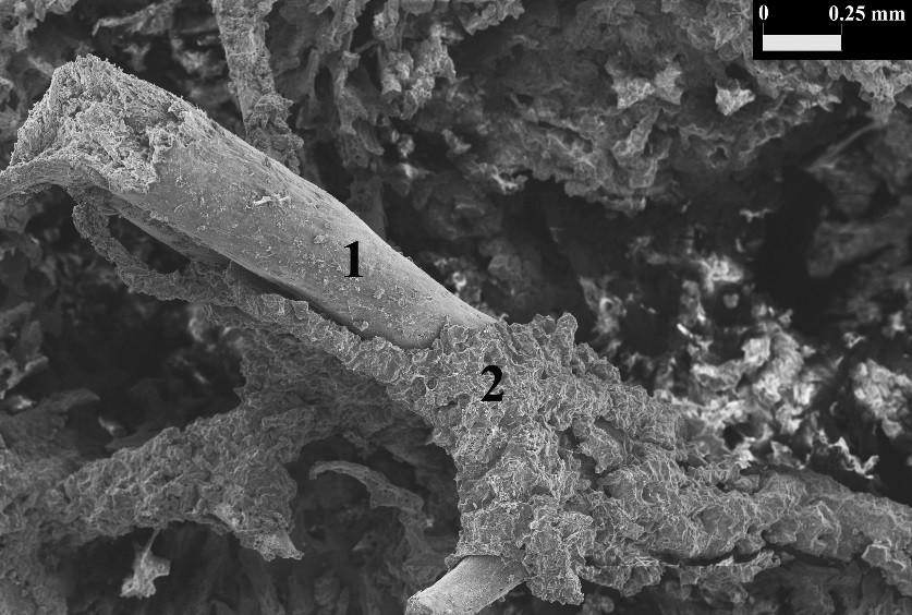 17. ábra: Nekrotikus csontgerendák (1) rendezetlen szerkezetű újcsont-réteggel körbefogva (2) (SEM-felvétel, szeméremcsont szklerotikus góc). Fig.