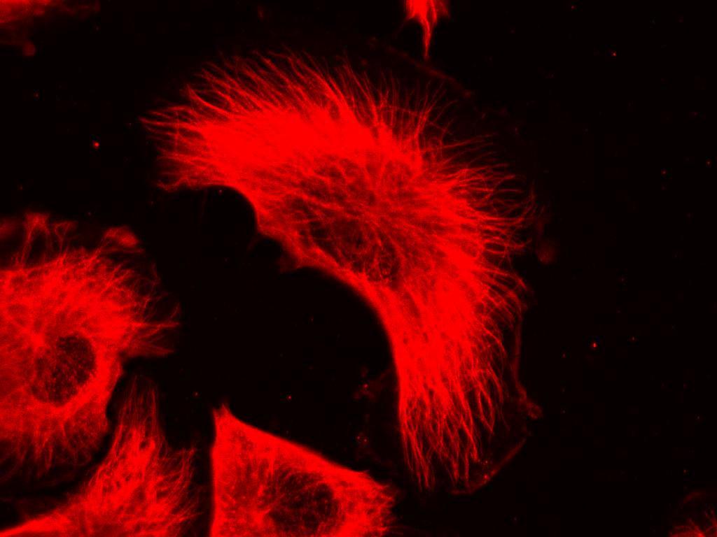 4. ábra. Mikrotubulus-rendszer migráló fibrosarcoma tumorsejtekben. 5. ábra Vimentin (zöld) és aktinszálak (piros) helyzete 3D migráció során.