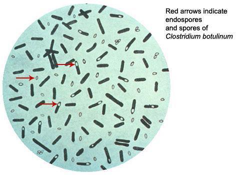 Endospóraképzés Bacillus, Clostridium, Sporosarcina sp.