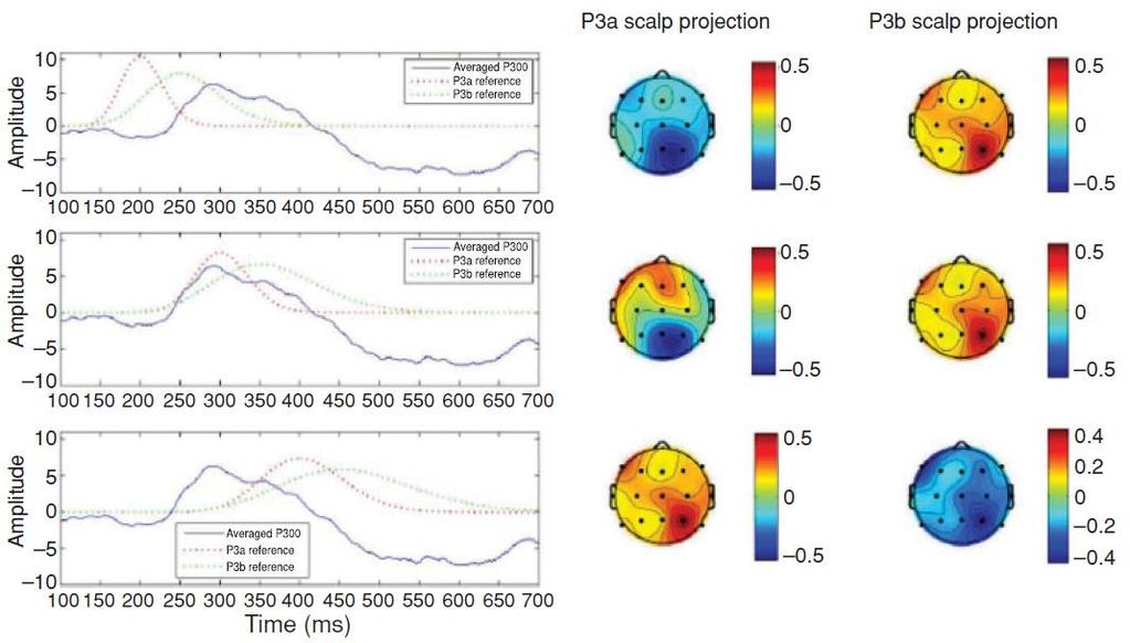 P3a és P3b szétválasztása Kísérlet: fülhallgatón keresztül 2 khz-es hangokat játszottak le (160 darabot egy futásban), közbeékelve 1 khz-esekkel (40 darabot egy futásban).