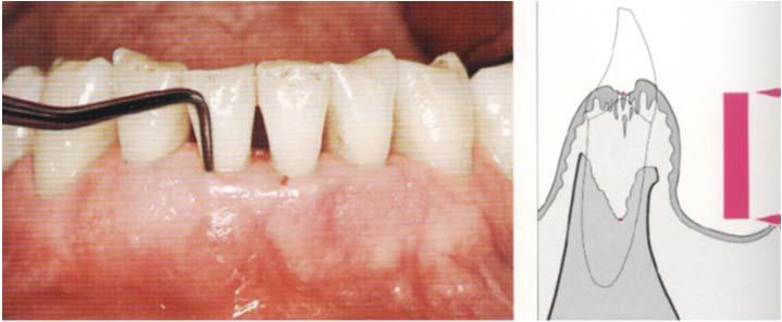 and Implant Dentistry