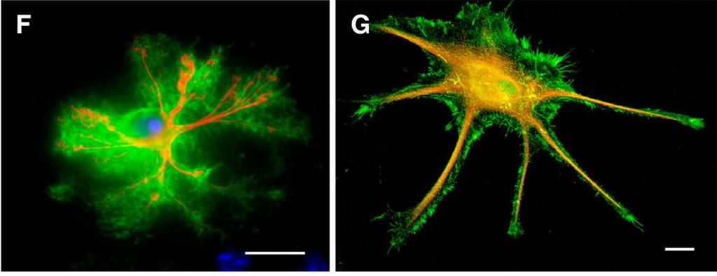 GFAP/GFP in vivo GFAP/ezrin in vitro plazamembrán