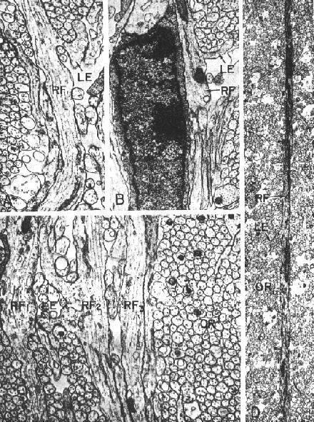 Radiális glia Golgi impregnált telencephalon, 97 napos majom