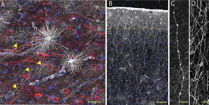 Hominid-specific astrocytic phenotypes pervade the human brain. (a) Varicose projection astrocytes reside in layers 5 6 and extend long processes characterized by evenly spaced varicosities.