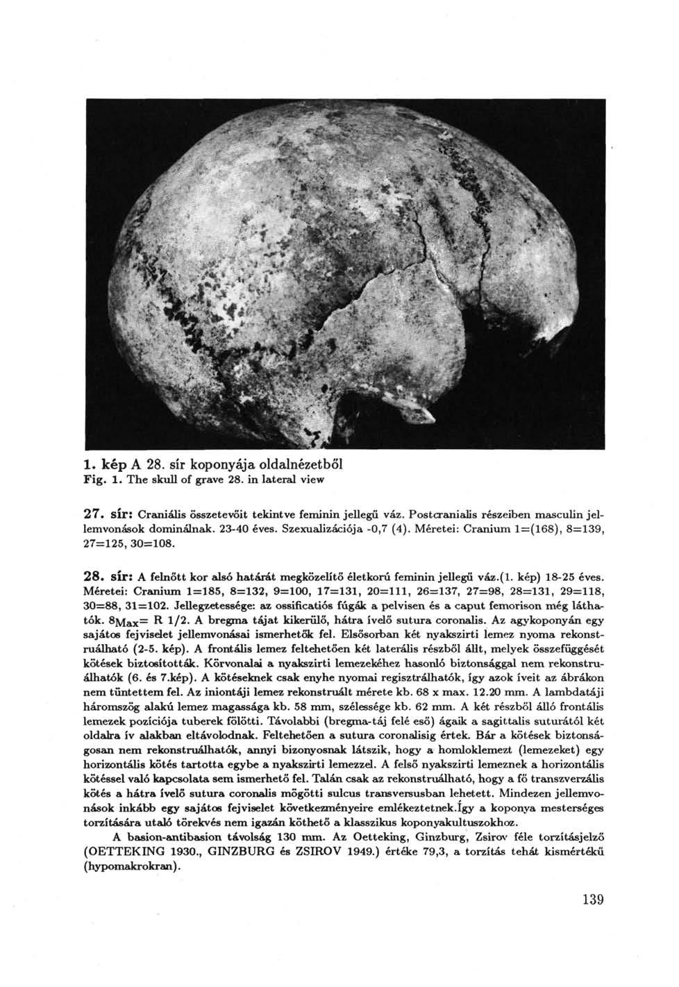 1. kép A 28. sír koponyája oldalnézetből Fig. 1. The skull of grave 28. in lateral view 27. Sir: Craniális összetevőit tekintve feminin jellegű váz.