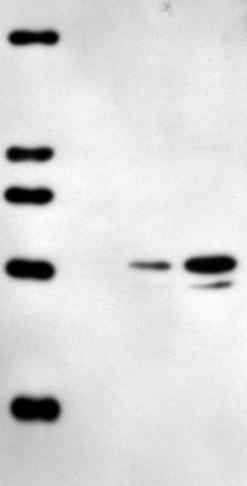 (SDS, MEA) Futtatás: 10% SDS PAGE fésű nélkül, 150 µl minta Immunoblotting: antitestek