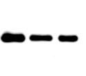 Immunoprecipitation of FXIII-B by FXIII-B antibodies from plasma FXIII-B (1) FXIII-B (2) FXIII A 2 B 2 5x 10x 5x 10x Polyclonal human FXIII-B FXIII-B (1) FXIII-B (2) FXIII A 2 B 2 5x 10x 5x 10x