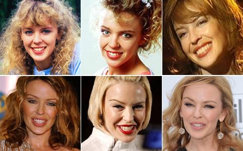 Kylie Minogue, aki tagadja Kylie Minogue nyilatkozataiban hevesen tagadja, hogy a mellrákja miatt szükségessé vált helyreállító operáción