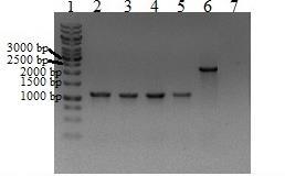 4. ábra A génspecifikus kazetta bejuttatásának ellenőrzése polimeráz láncreakcióval, és a PCR termékek futtatása 1%-os agaróz gélen 1: 1 kb DNS molekulasúly-marker (Fermentas, 1 µl); 2, 3, 4, 5: