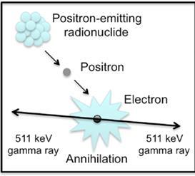 Pozitron emissziós tomográfia alapelve Szervezetbe pozitron kibocsátására képes radioaktív izotópot tartalmazó anyagot visznek cukoroldatban.
