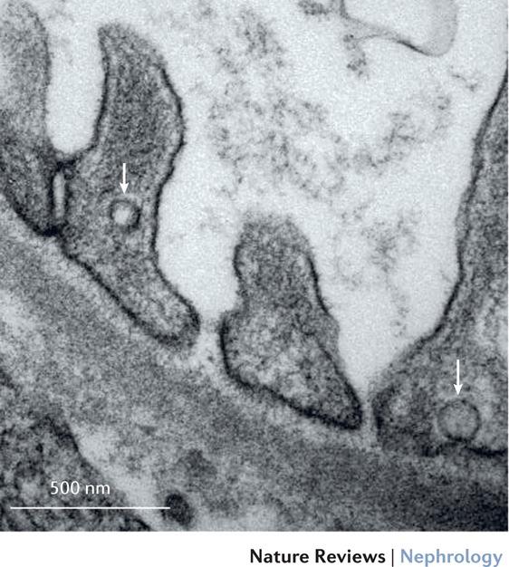 Nephrol. doi:10.