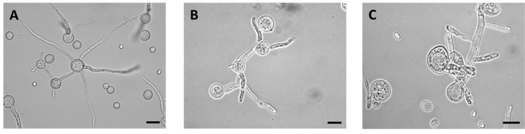 16. ábra. Az MS12 (A, D), valamint az MS12+pAS3/1 (B, E) és MS12+pAS3/2 (C, F) izolátumok fény- (A-C) és fluoreszcens (D-F) mikroszkópos képe Annexin V-FITC és propídium-jodid festést követően.