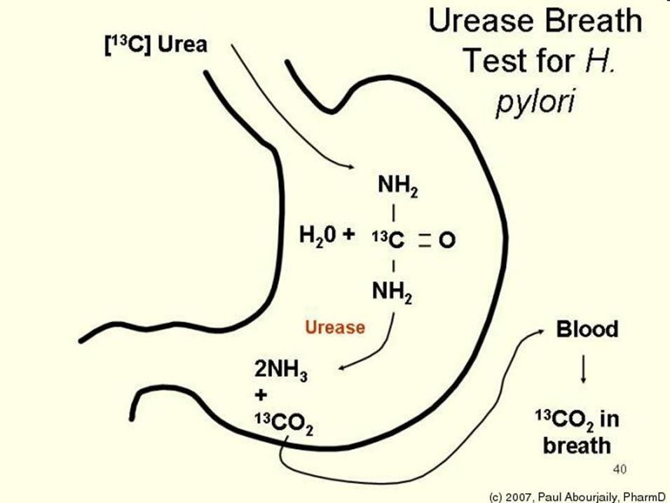 Helicobacter pylori kimutatás