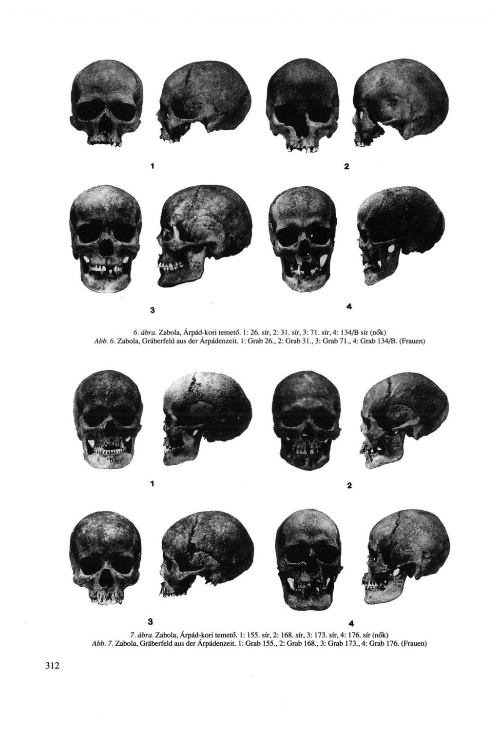 . ábra. Zabola, Árpád-kori temető. :. sír, :. sír, :7. sír, : /B sír (nők) Abb.. Zabola, Gräberfeld aus der Arpádenzeit. : Grab., : Grab., : Grab 7., : Grab /B. (Frauen) 7.