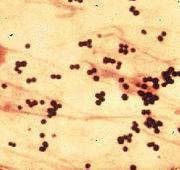 Streptococcus salivarius