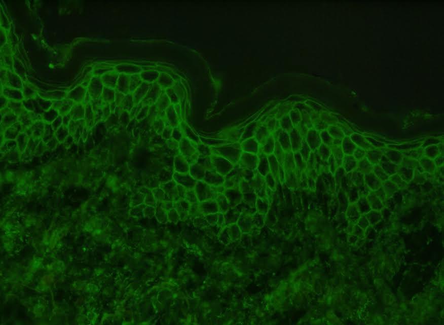 Direkt immunfluoreszcens vizsgálat