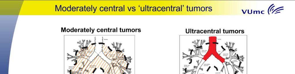 Centralis elhelyezkedés - Proximal