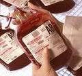 A transzfúzió szignifikáns kockázati tényezőt jelenthet a beteg számára A transzfúzió kockázatai: 1-4 Vírus és bakteriális infekciók Tüdőödéma Haemolítikus reakciók Allergiás reakciók