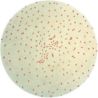 mandulákon tapad meg és vaskos, szürkés lepedéket hoz létre - fulladásveszély o baktérium mérget (toxint) termel http://www.